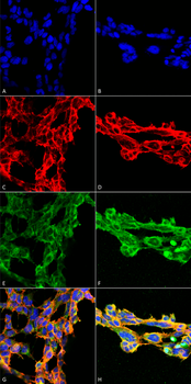 7-Ketocholesterol Antibody (RPE)