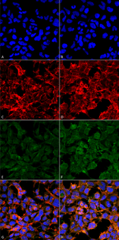 Malondialdehyde Antibody: FITC