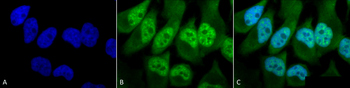 Phosphothreonine Antibody: Biotin