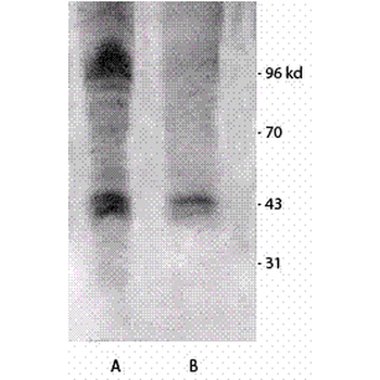 Phosphothreonine Antibody: Biotin