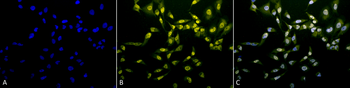 Phosphothreonine Antibody: Biotin