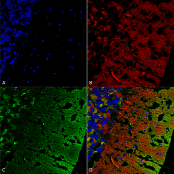 Alpha Synuclein Antibody: Biotin