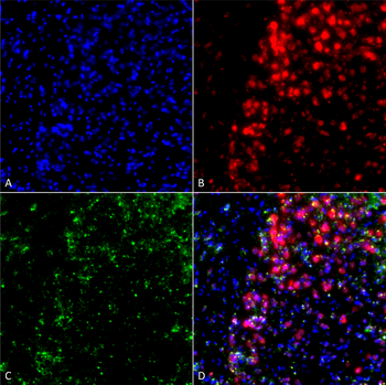 Alpha Synuclein Antibody: Biotin