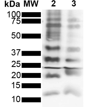 Ubiquitin Antibody: APC