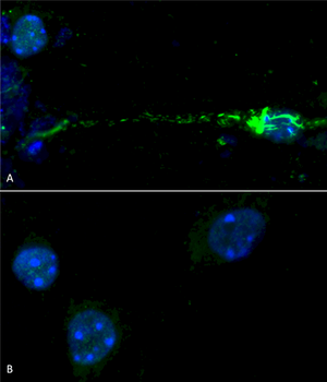 Alpha Synuclein Antibody (pSer129): Biotin