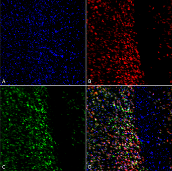 Alpha Synuclein Antibody (pSer129): Biotin