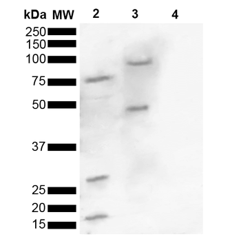 Alpha Synuclein Antibody (pSer129): Biotin