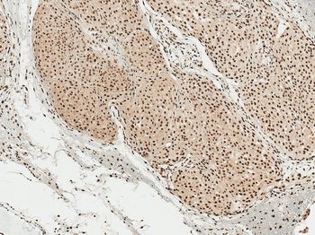 Alpha Synuclein Antibody (pSer129): Biotin