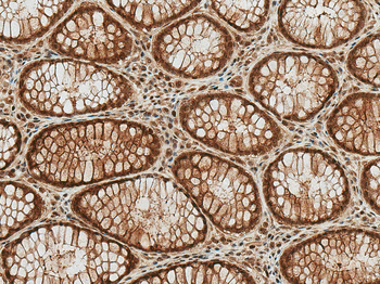HSP70 Antibody (Acetyl Lys77): FITC