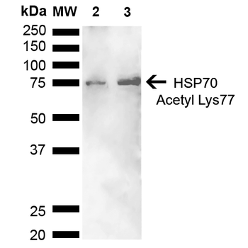 HSP70 Antibody (Acetyl Lys77): FITC