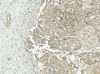 CBP Antibody (RPE)