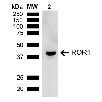 ROR1 Antibody (APC)