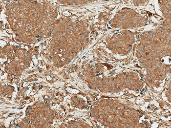 ROR1 Antibody: Biotin