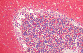 Alpha Synuclein Antibody: Biotin