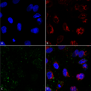 HSP70 Antibody