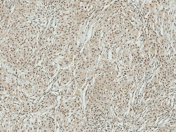ATG7 Antibody: PerCP