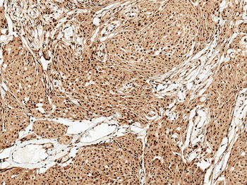 FUNDC1 Antibody: Biotin
