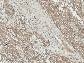 IGF-1 Antibody: FITC