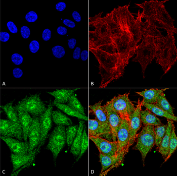 IGF-1 Antibody (RPE)
