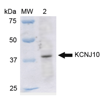 Kir4.1 Antibody: RPE