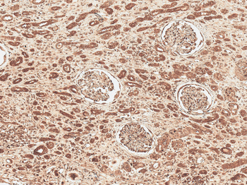 FNIP1 Antibody: APC