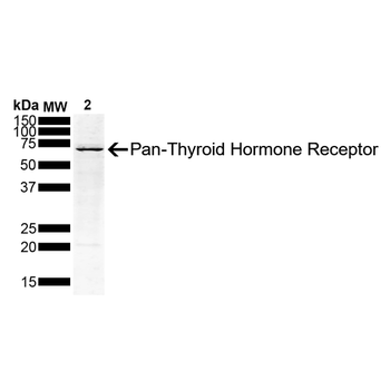 Thyroid Hormone Receptor Antibody: APC