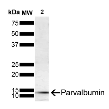 parvalbumin Antibody (RPE)