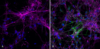 Alpha Synuclein Antibody (pSer129): Biotin