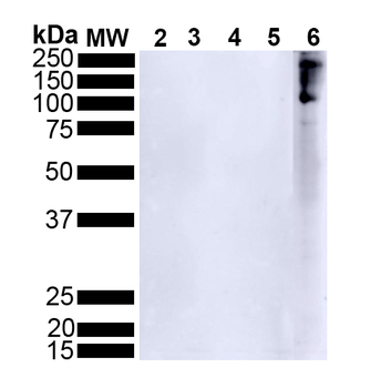 Alpha Synuclein Antibody (pSer129): Biotin