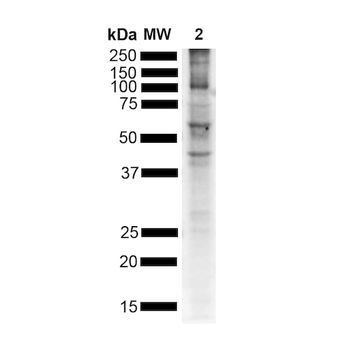 Alpha Synuclein Antibody (pSer129): Biotin