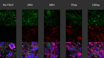 Alpha Synuclein Antibody (pSer129): Biotin