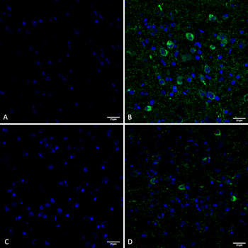 Tau Antibody (pSer202/ pThr205): Biotin