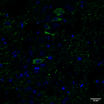 Tau Antibody (pSer202/ pThr205): Biotin