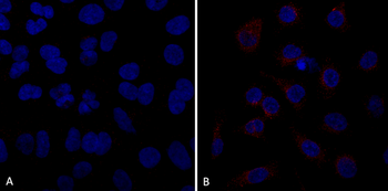 VPS35 Antibody: FITC
