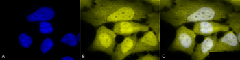 Phosphoserine Antibody