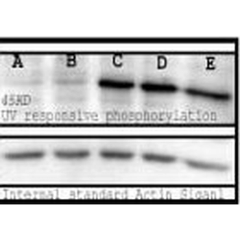 Phosphoserine Antibody