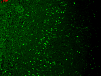 TRPM7 Antibody