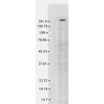 TRPM7 Antibody
