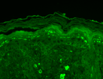 SHANK3 Antibody