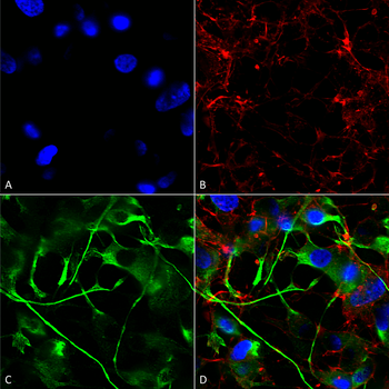 VAChT Antibody