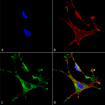 MMP9 Antibody