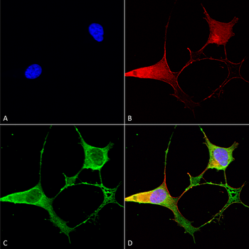 Ankyrin B Antibody
