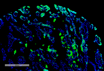 Thymidine Glycol Antibody (RPE)