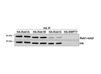 RAB1A Antibody: RPE