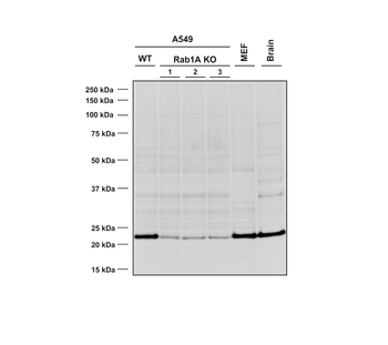RAB1A Antibody: RPE