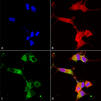 NALCN Antibody