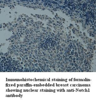 NOTCH1 Rabbit Polyclonal Antibody