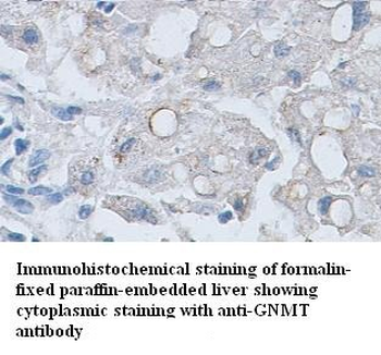 GNMT Rabbit Polyclonal Antibody