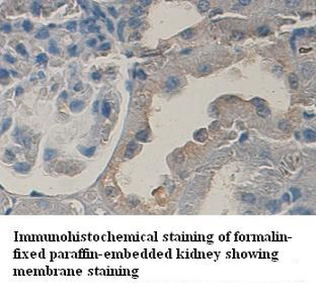 COX2 Rabbit Polyclonal Antibody