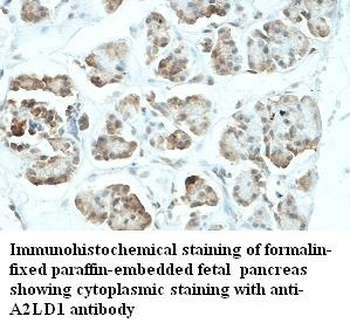 GGACT Rabbit Polyclonal Antibody